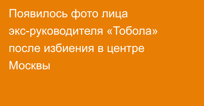 Появилось фото лица экс-руководителя «Тобола» после избиения в центре Москвы