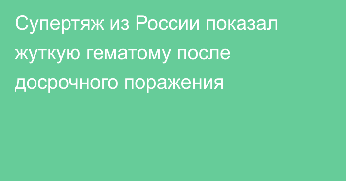 Супертяж из России показал жуткую гематому после досрочного поражения