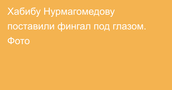 Хабибу Нурмагомедову поставили фингал под глазом. Фото